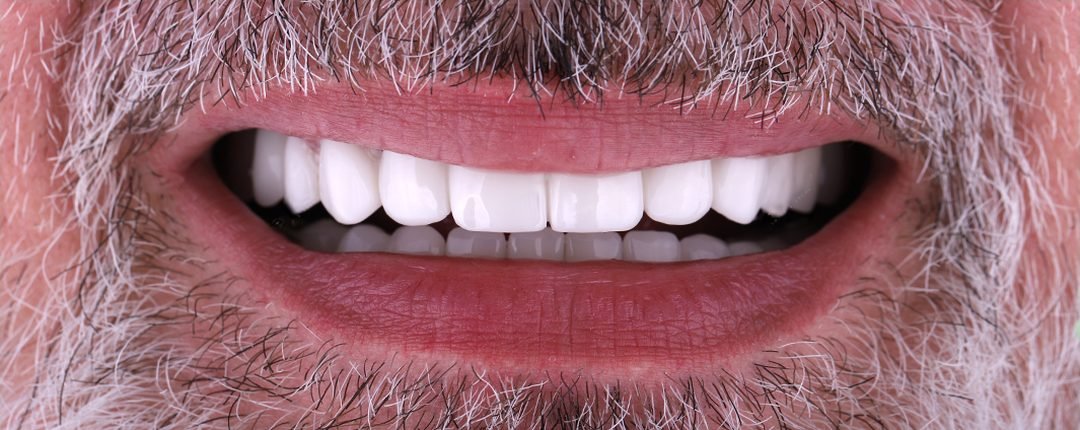After treatment