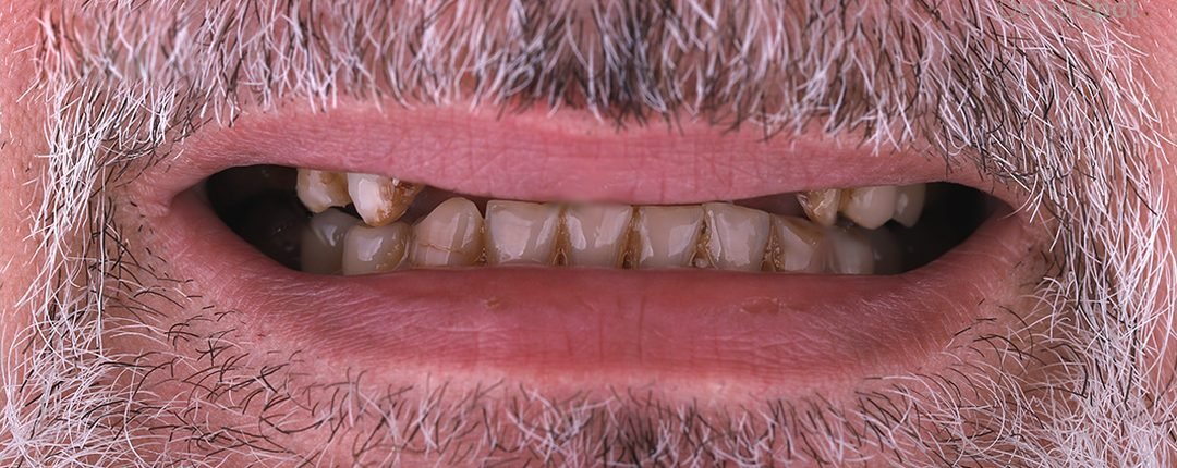 Before treatment